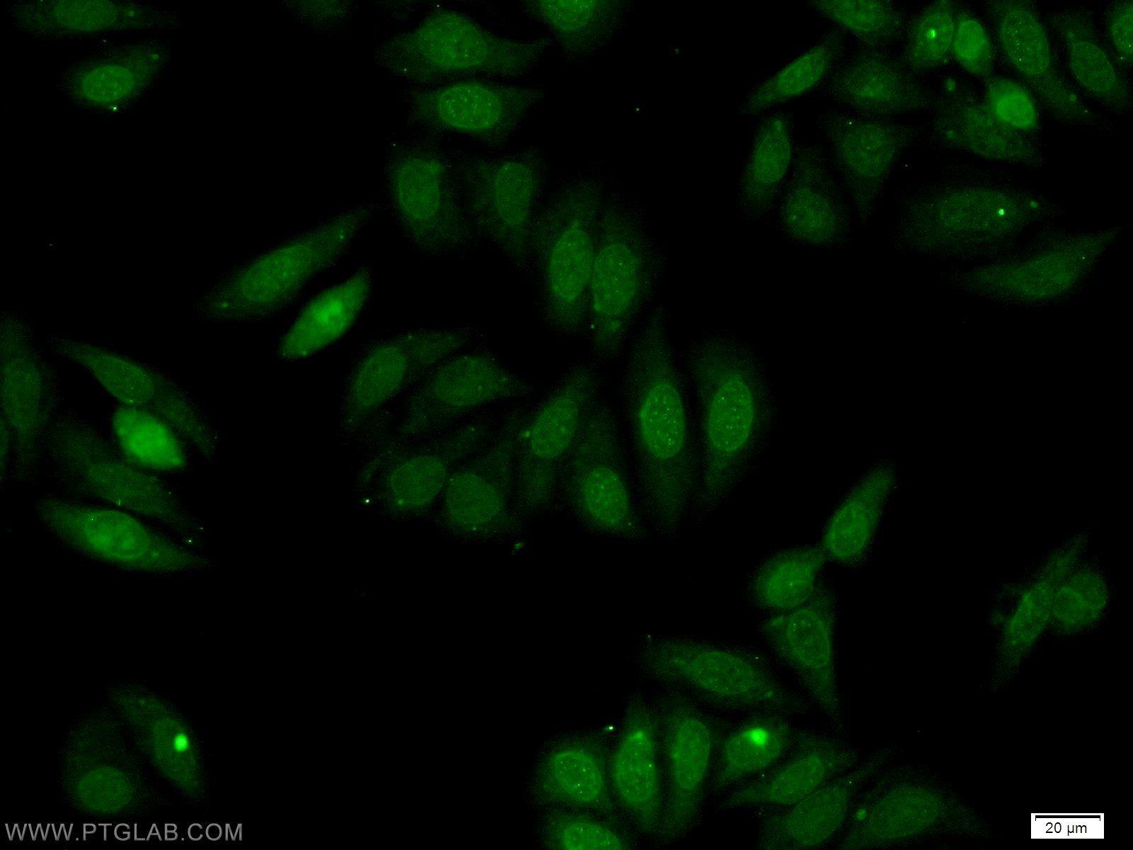 IF Staining of HeLa using 19943-1-AP