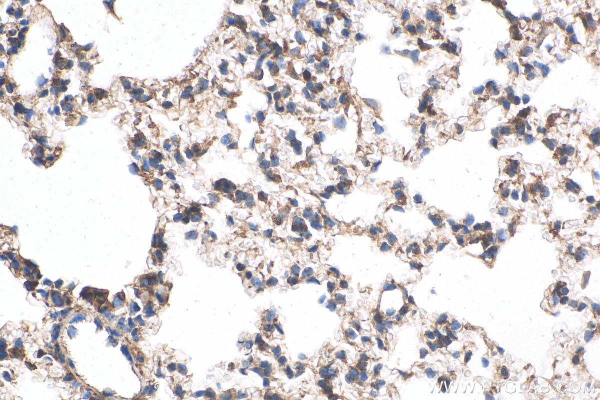 Immunohistochemistry (IHC) staining of mouse lung tissue using ERBB4 Polyclonal antibody (19943-1-AP)