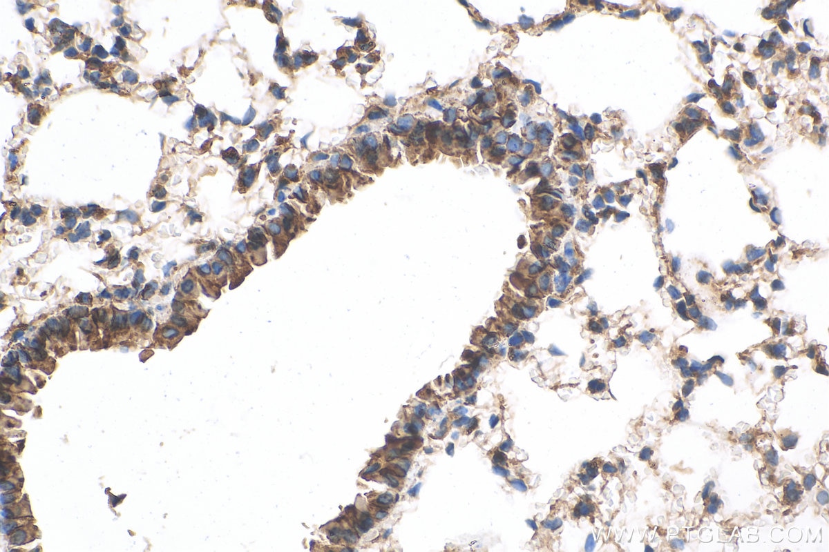 Immunohistochemistry (IHC) staining of mouse lung tissue using ERBB4 Polyclonal antibody (19943-1-AP)