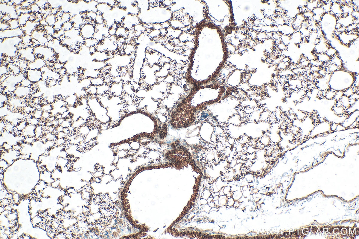 Immunohistochemistry (IHC) staining of mouse lung tissue using ERBB4 Polyclonal antibody (19943-1-AP)