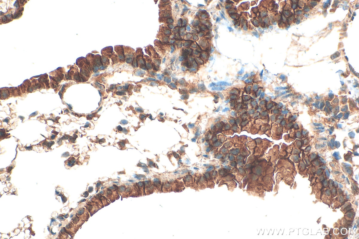 Immunohistochemistry (IHC) staining of mouse lung tissue using ERBB4 Polyclonal antibody (19943-1-AP)