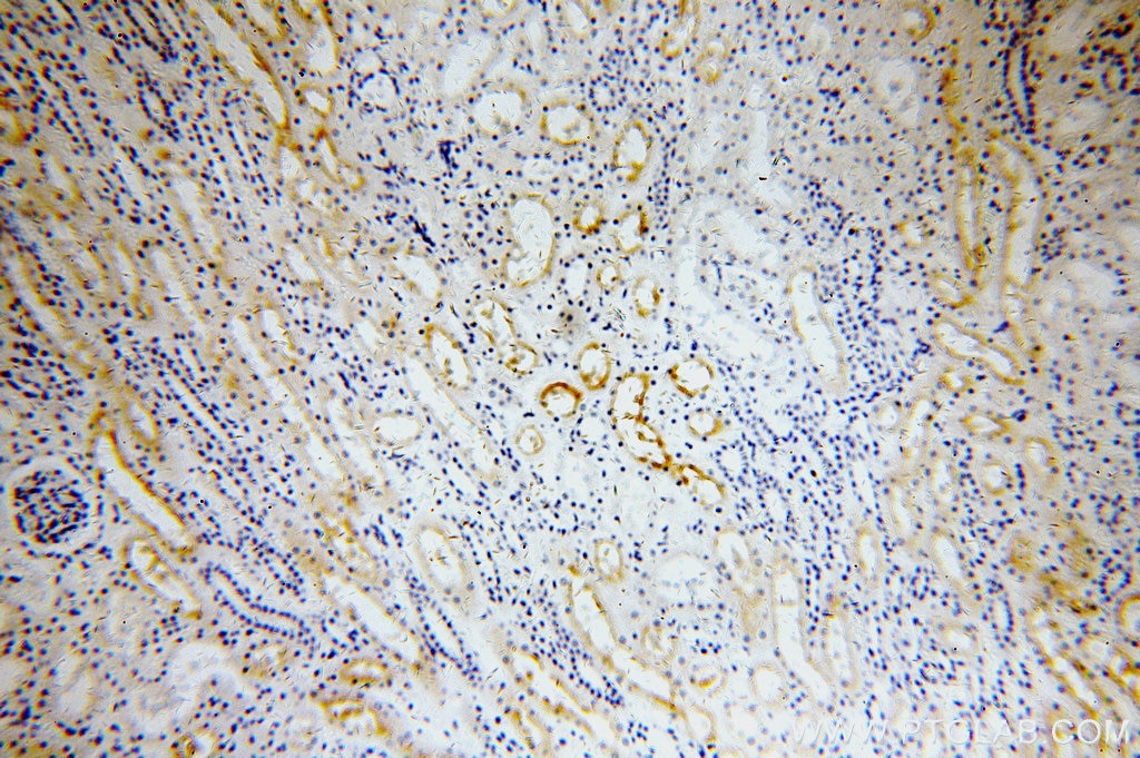 Immunohistochemistry (IHC) staining of human kidney tissue using ERBB4 Polyclonal antibody (19943-1-AP)