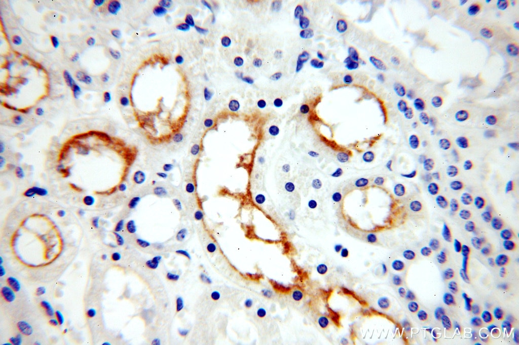 Immunohistochemistry (IHC) staining of human kidney tissue using ERBB4 Polyclonal antibody (19943-1-AP)