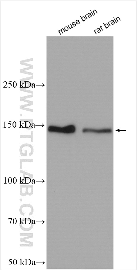 Western Blot (WB) analysis of various lysates using ERBB4 Polyclonal antibody (19943-1-AP)