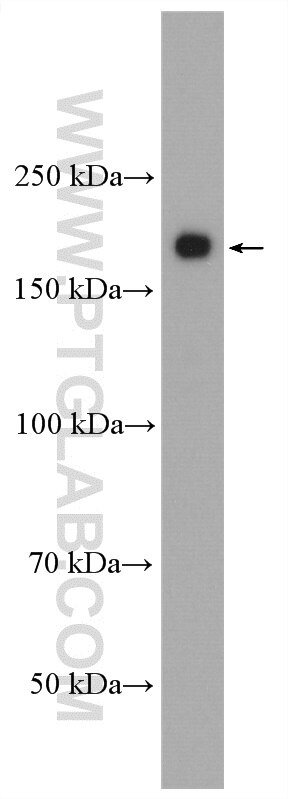 Western Blot (WB) analysis of mouse brain tissue using ERBB4 Polyclonal antibody (19943-1-AP)