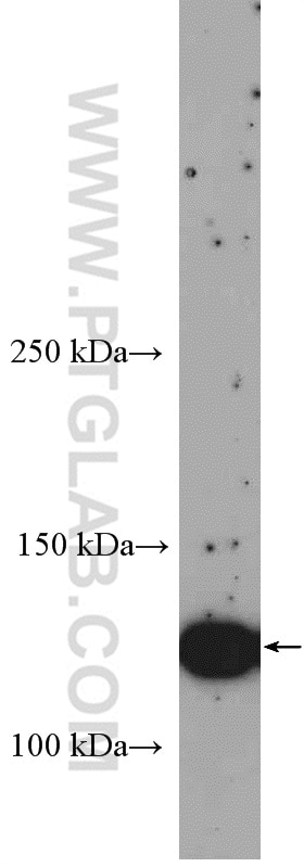 Western Blot (WB) analysis of MCF-7 cells using ERBB4 Polyclonal antibody (19943-1-AP)