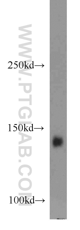 Western Blot (WB) analysis of mouse brain tissue using ERBB4 Polyclonal antibody (19943-1-AP)