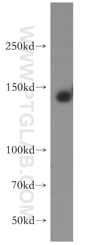 Western Blot (WB) analysis of mouse brain tissue using ERBB4 Polyclonal antibody (19943-1-AP)