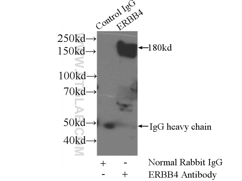 Immunoprecipitation (IP) experiment of mouse brain tissue using ERBB4 Polyclonal antibody (22387-1-AP)