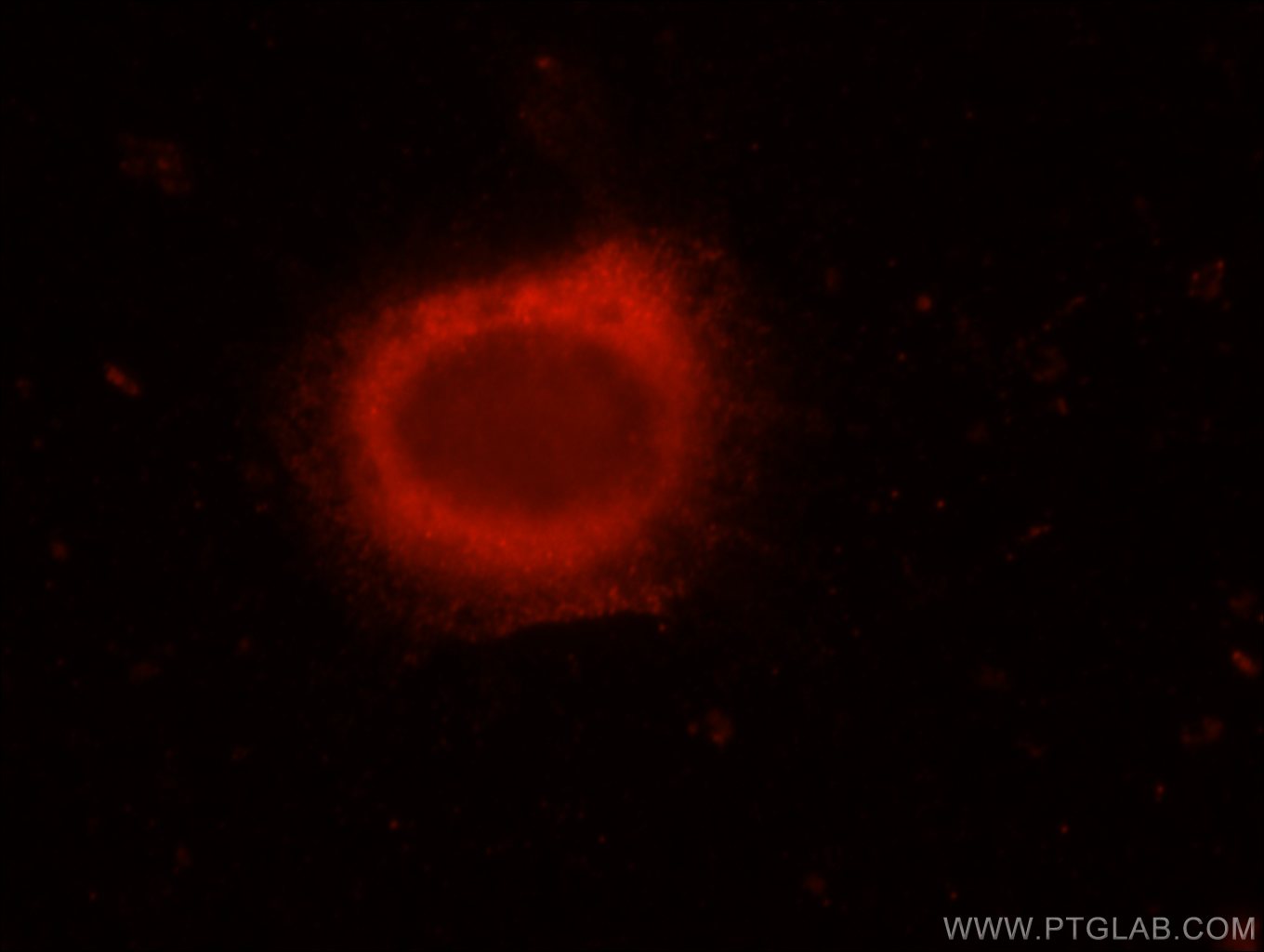 Immunofluorescence (IF) / fluorescent staining of MCF-7 cells using ERC1 Polyclonal antibody (22211-1-AP)