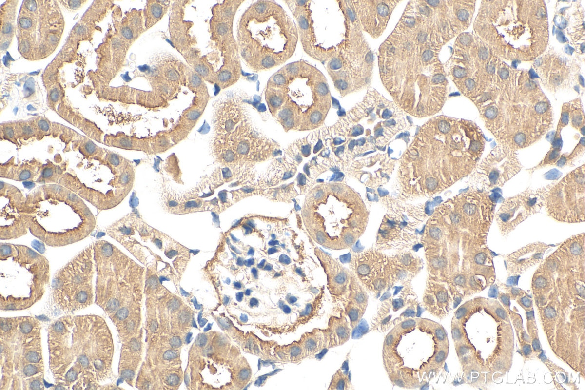 Immunohistochemistry (IHC) staining of mouse kidney tissue using ERC1 Polyclonal antibody (22211-1-AP)