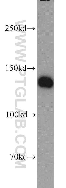 Western Blot (WB) analysis of HeLa cells using ERC1 Polyclonal antibody (22211-1-AP)