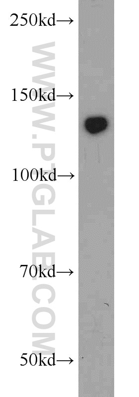 Western Blot (WB) analysis of Jurkat cells using ERC1 Polyclonal antibody (22211-1-AP)