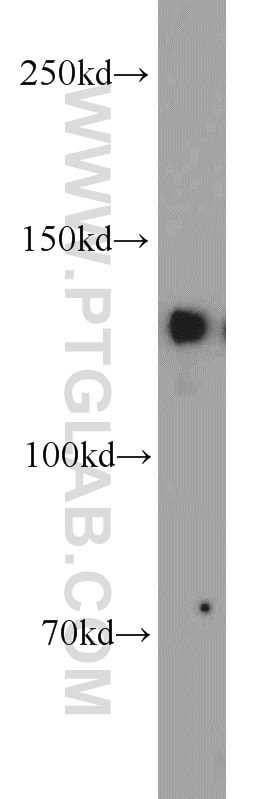 Western Blot (WB) analysis of COLO 320 cells using ERC1 Polyclonal antibody (22211-1-AP)