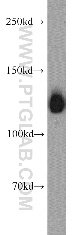 Western Blot (WB) analysis of human testis tissue using ERC1 Polyclonal antibody (22211-1-AP)