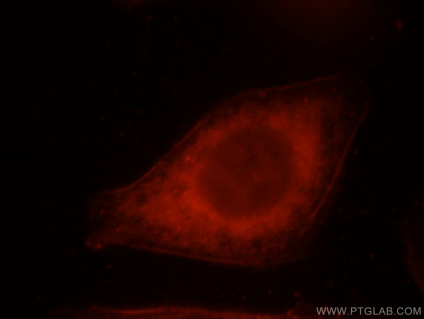 Immunofluorescence (IF) / fluorescent staining of HeLa cells using ERC2 Polyclonal antibody (21396-1-AP)