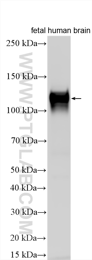 Western Blot (WB) analysis of various lysates using ERC2 Polyclonal antibody (21396-1-AP)