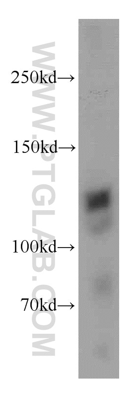 WB analysis of rat brain using 21396-1-AP