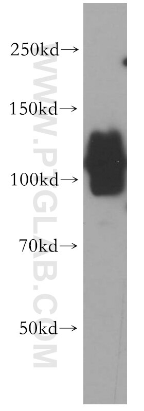 Western Blot (WB) analysis of human brain tissue using ERC2 Polyclonal antibody (21396-1-AP)