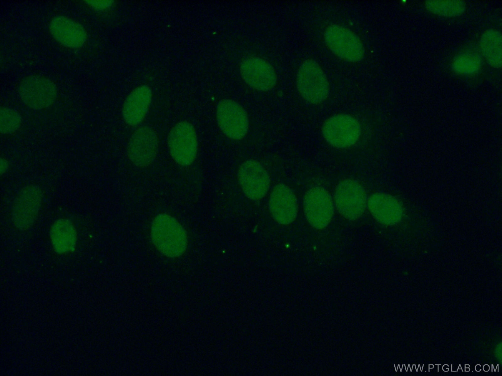 Immunofluorescence (IF) / fluorescent staining of MCF-7 cells using ERCC1 Polyclonal antibody (14586-1-AP)