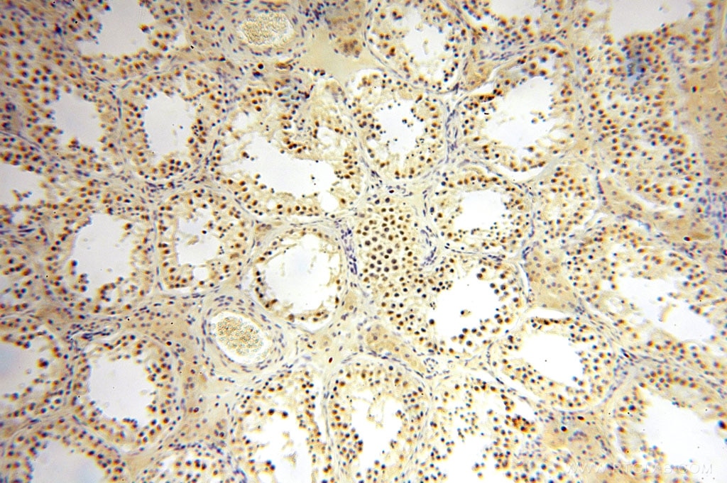 Immunohistochemistry (IHC) staining of human testis tissue using ERCC1 Polyclonal antibody (14586-1-AP)