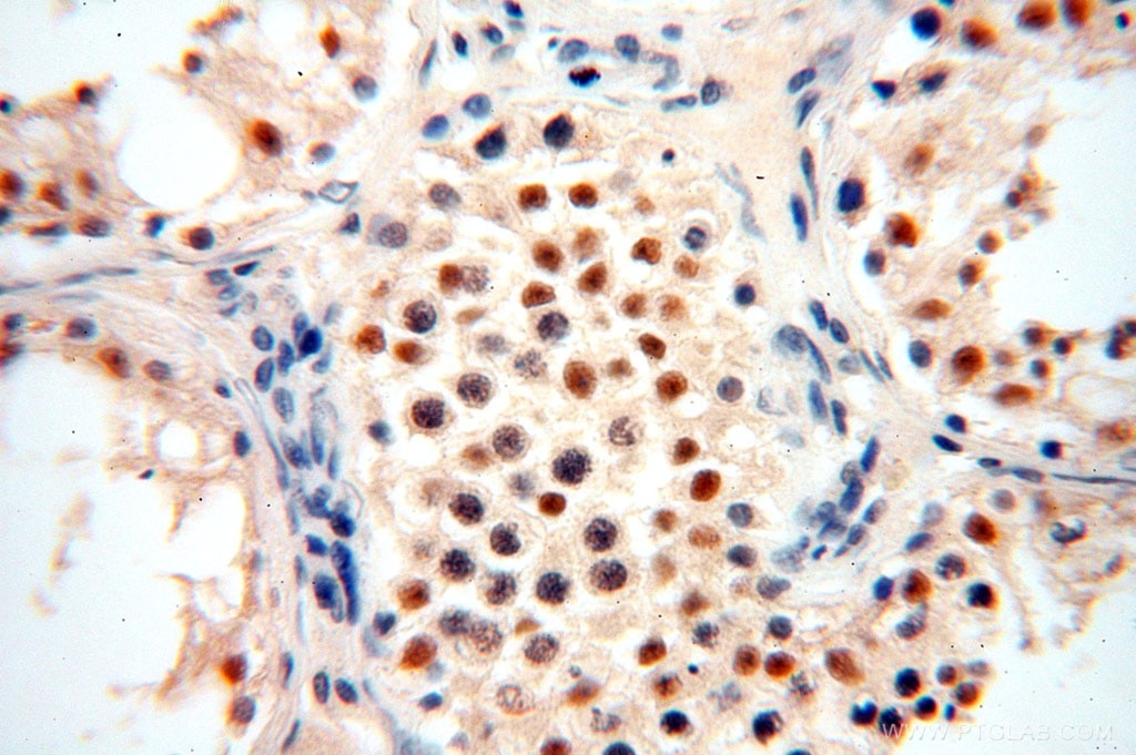 Immunohistochemistry (IHC) staining of human testis tissue using ERCC1 Polyclonal antibody (14586-1-AP)