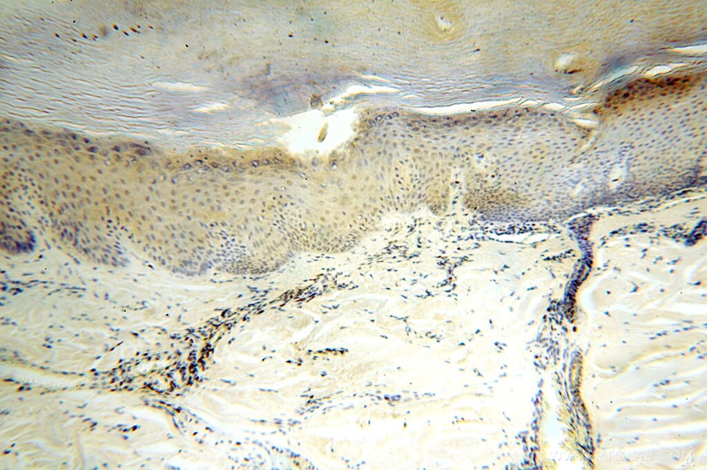 Immunohistochemistry (IHC) staining of human skin tissue using ERCC1 Polyclonal antibody (14586-1-AP)