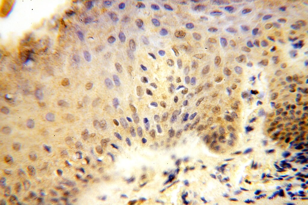 Immunohistochemistry (IHC) staining of human skin tissue using ERCC1 Polyclonal antibody (14586-1-AP)