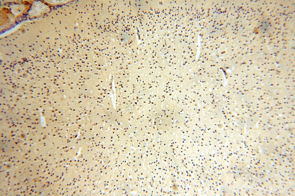 Immunohistochemistry (IHC) staining of human brain tissue using ERCC1 Polyclonal antibody (14586-1-AP)