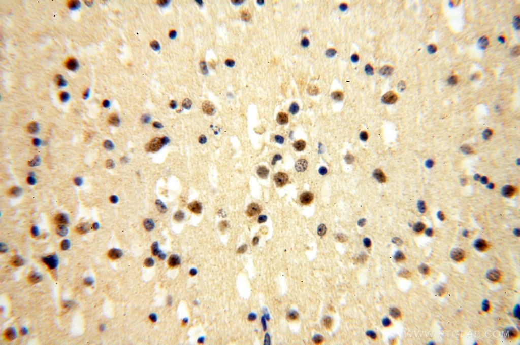 Immunohistochemistry (IHC) staining of human brain tissue using ERCC1 Polyclonal antibody (14586-1-AP)