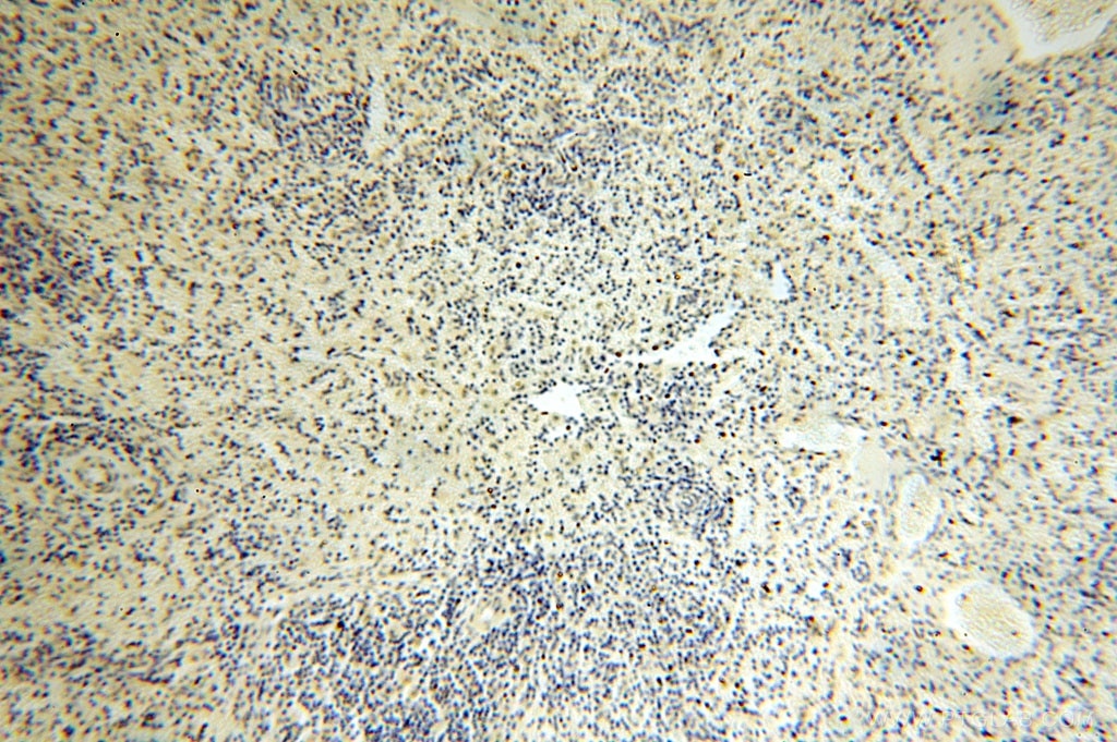 Immunohistochemistry (IHC) staining of human spleen tissue using ERCC1 Polyclonal antibody (14586-1-AP)