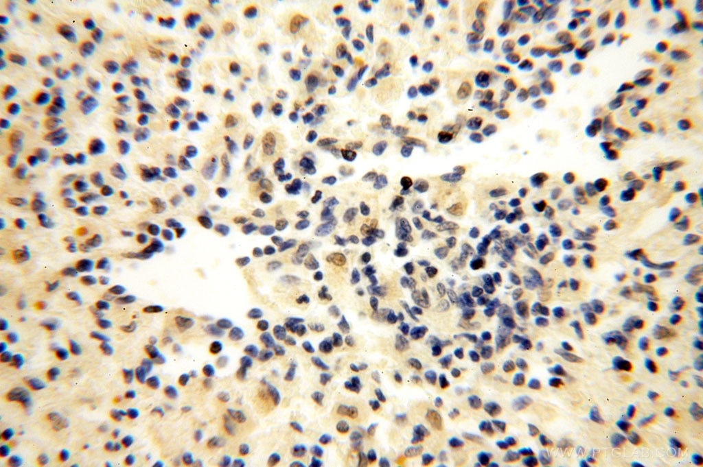 Immunohistochemistry (IHC) staining of human spleen tissue using ERCC1 Polyclonal antibody (14586-1-AP)