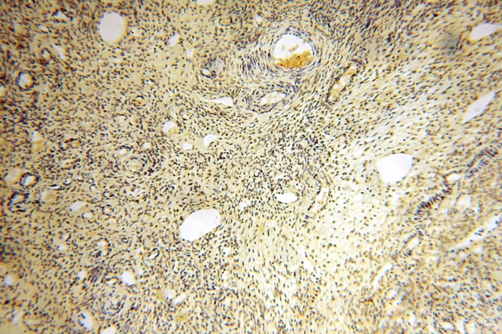 Immunohistochemistry (IHC) staining of human ovary tissue using ERCC1 Polyclonal antibody (14586-1-AP)