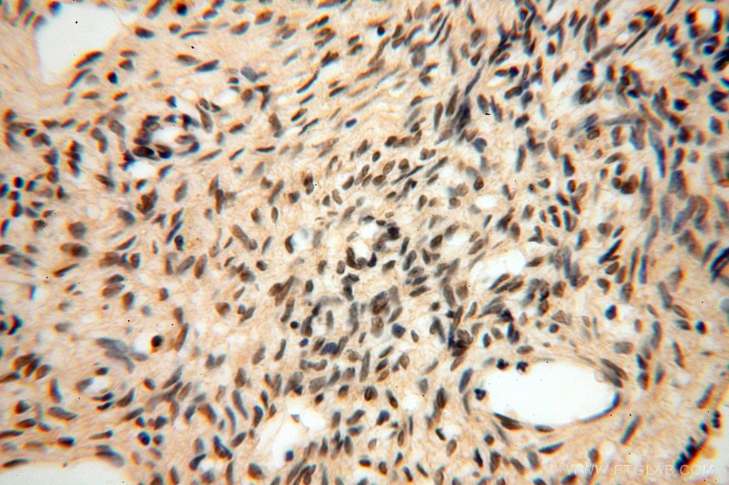 Immunohistochemistry (IHC) staining of human ovary tissue using ERCC1 Polyclonal antibody (14586-1-AP)