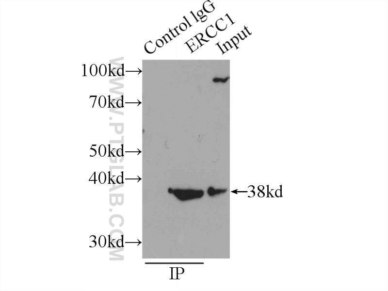 Immunoprecipitation (IP) experiment of MCF-7 cells using ERCC1 Polyclonal antibody (14586-1-AP)