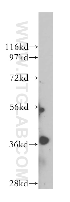 Western Blot (WB) analysis of human kidney tissue using ERCC1 Polyclonal antibody (14586-1-AP)