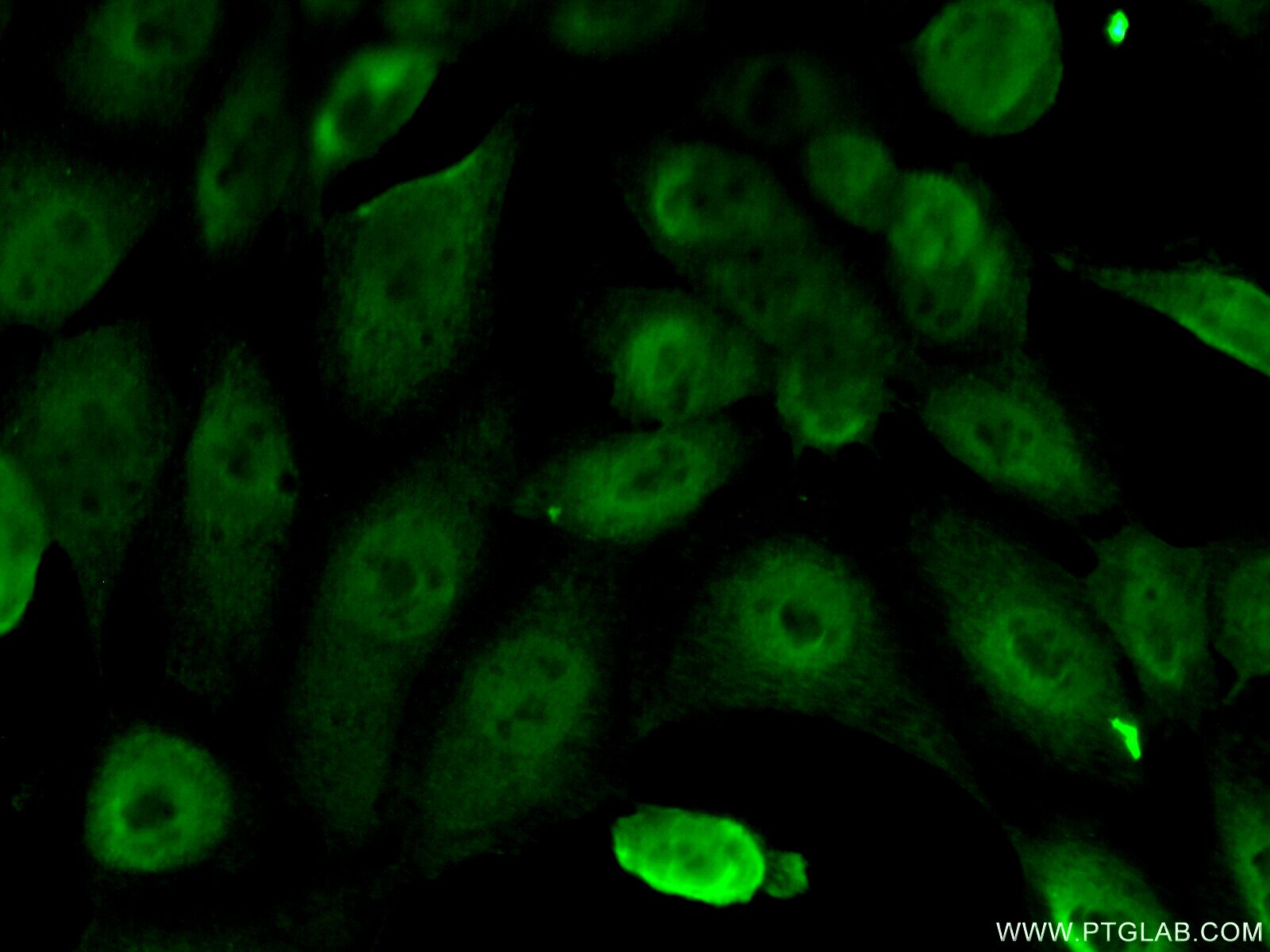 Immunofluorescence (IF) / fluorescent staining of A431 cells using ERCC1 Monoclonal antibody (66275-1-Ig)