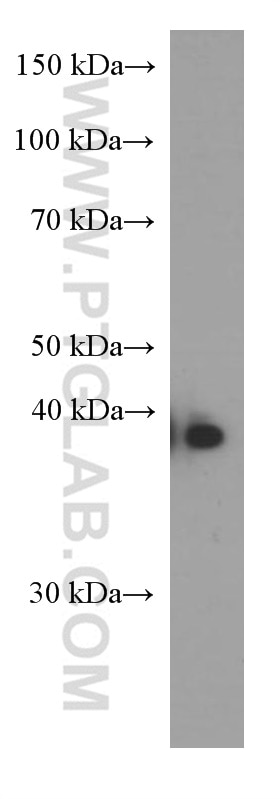 Western Blot (WB) analysis of A431 cells using ERCC1 Monoclonal antibody (66275-1-Ig)