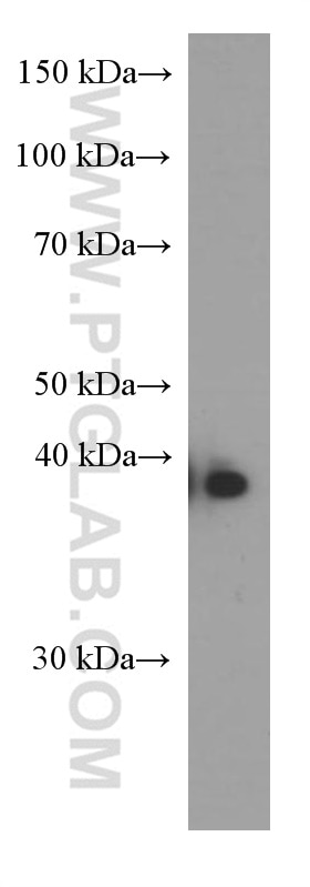 WB analysis of A431 using 66275-1-Ig