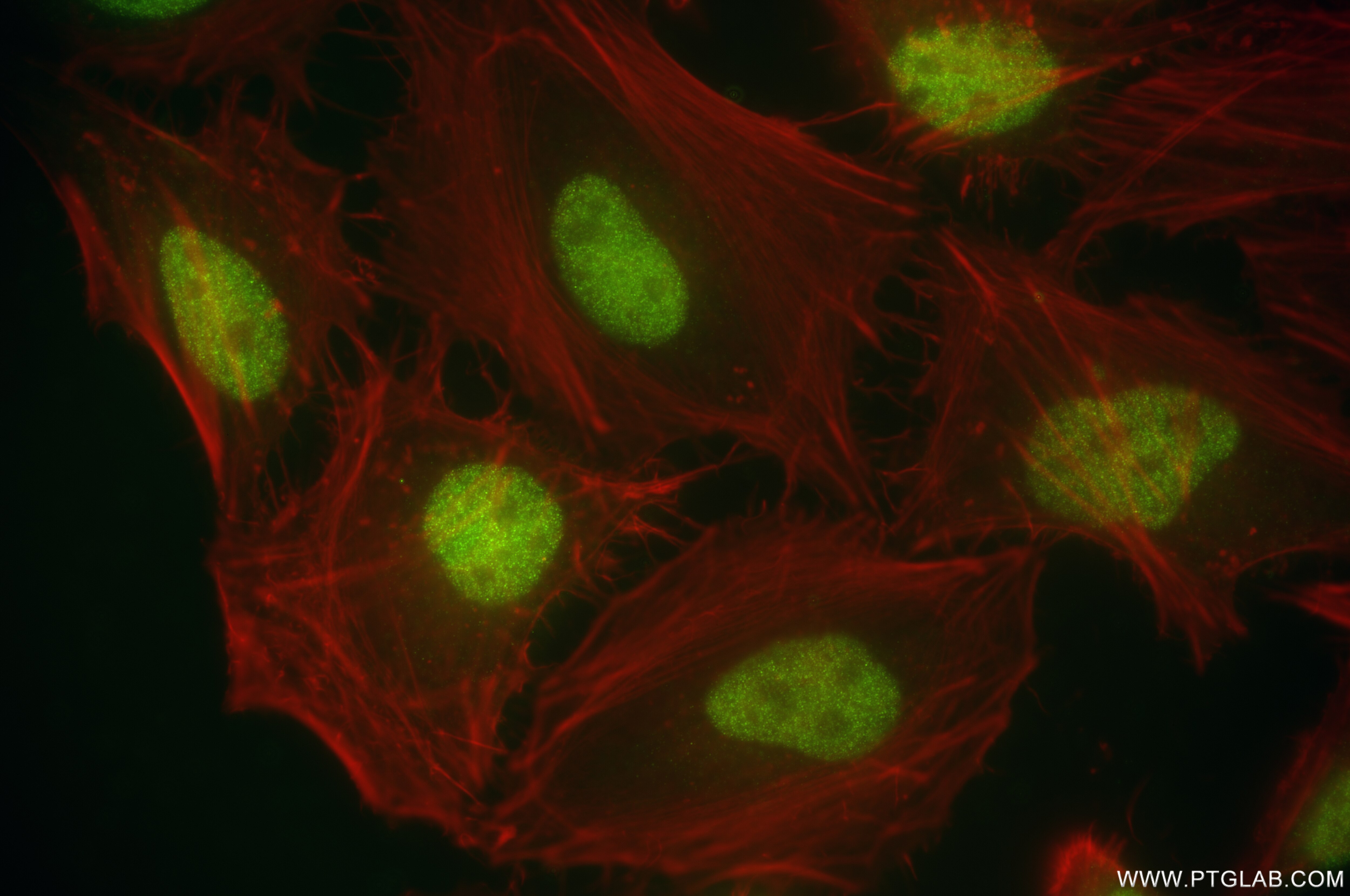 Immunofluorescence (IF) / fluorescent staining of HeLa cells using ERCC1 Recombinant monoclonal antibody (87175-3-RR)