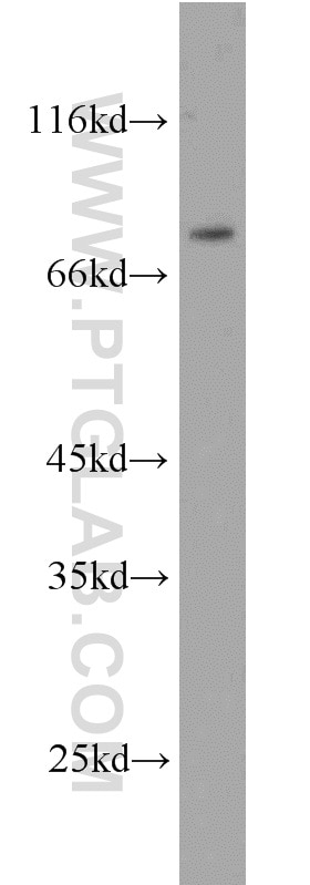 Western Blot (WB) analysis of HeLa cells using ERCC2 Polyclonal antibody (10818-1-AP)