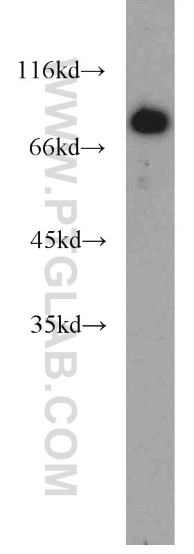 Western Blot (WB) analysis of K-562 cells using ERCC2 Polyclonal antibody (10818-1-AP)