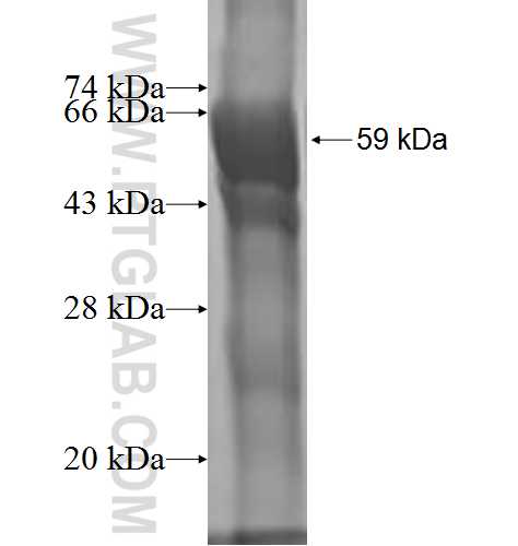 ERCC2 fusion protein Ag1038 SDS-PAGE