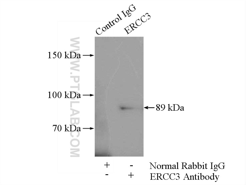 Immunoprecipitation (IP) experiment of A431 cells using ERCC3 Polyclonal antibody (10580-1-AP)