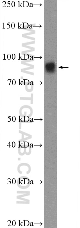 Western Blot (WB) analysis of mouse colon tissue using ERCC3 Polyclonal antibody (10580-1-AP)