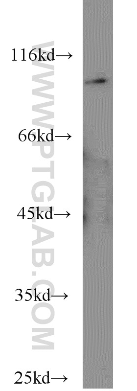 WB analysis of HeLa using 10580-1-AP