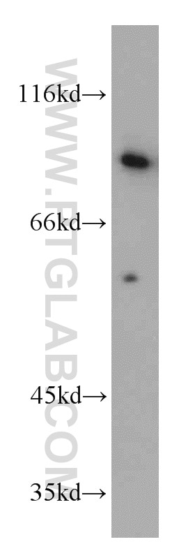 Western Blot (WB) analysis of HEK-293 cells using ERCC3 Polyclonal antibody (10580-1-AP)