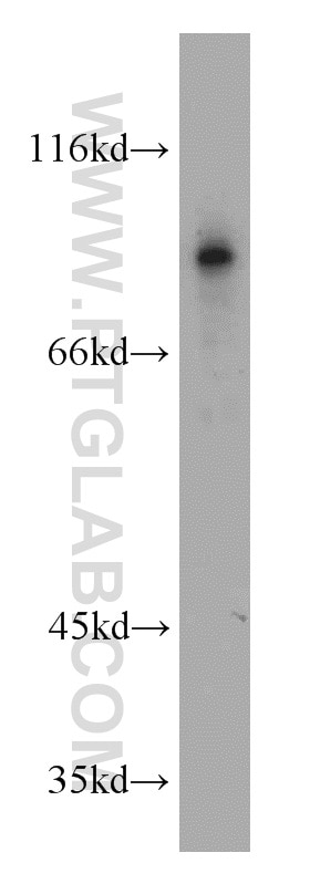 Western Blot (WB) analysis of HEK-293 cells using ERCC3 Polyclonal antibody (10580-1-AP)