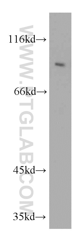 Western Blot (WB) analysis of HeLa cells using ERCC3 Polyclonal antibody (10580-1-AP)