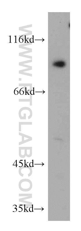 Western Blot (WB) analysis of HeLa cells using ERCC3 Polyclonal antibody (10580-1-AP)
